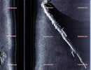 Sidescan sonar image of UC-42